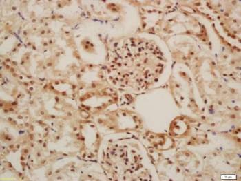 GLIS3 Rabbit Polyclonal Antibody