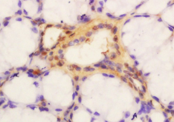 GLIS3 Rabbit Polyclonal Antibody