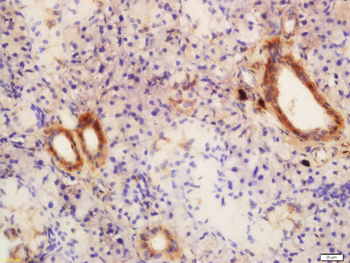 GLIS3 Rabbit Polyclonal Antibody