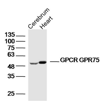 GPCR GPR75 Rabbit Polyclonal Antibody