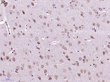 GPHB5 Rabbit Polyclonal Antibody