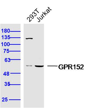 GPR152 Rabbit Polyclonal Antibody