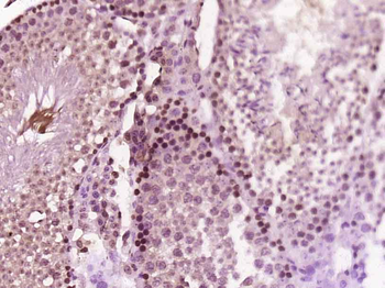 GTF2A2 Rabbit Polyclonal Antibody