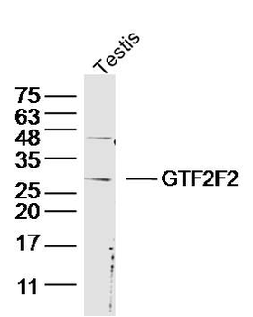 GTF2F2 Rabbit Polyclonal Antibody