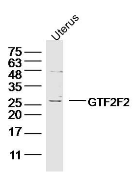 GTF2F2 Rabbit Polyclonal Antibody