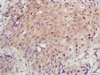 GTF2H2/TFIIH p44 Rabbit Polyclonal Antibody