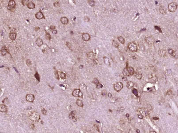GTPBP1 Rabbit Polyclonal Antibody