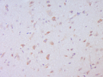 Guanylyl Cyclase beta 1 Rabbit Polyclonal Antibody