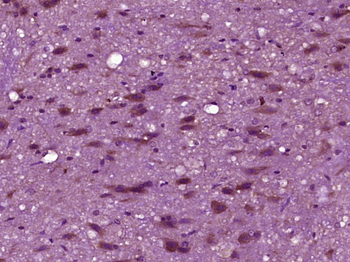 GAL Rabbit Polyclonal Antibody