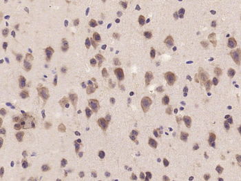 GAL Rabbit Polyclonal Antibody
