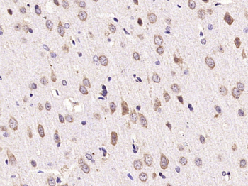 GAL Rabbit Polyclonal Antibody