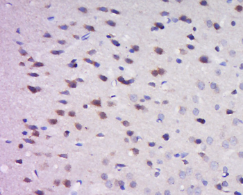 GRP Rabbit Polyclonal Antibody