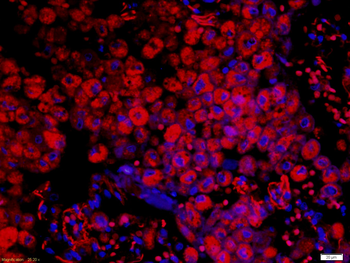 HLA Class 1 ABC /HLA ABC Rabbit Polyclonal Antibody