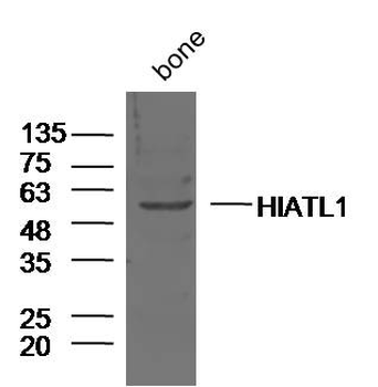 HIATL1 Rabbit Polyclonal Antibody