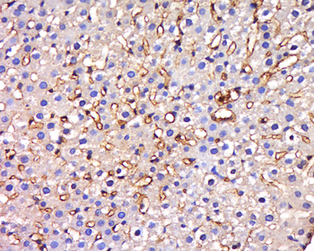 HIATL1 Rabbit Polyclonal Antibody