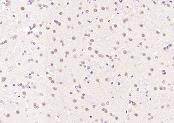 HnRNP M1-M4 Rabbit Polyclonal Antibody