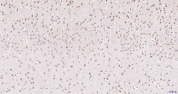 HnRNP M1-M4 Rabbit Polyclonal Antibody