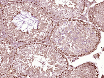 Homez Rabbit Polyclonal Antibody