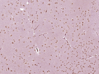 HOXC12 Rabbit Polyclonal Antibody