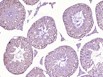 HOXC12 Rabbit Polyclonal Antibody