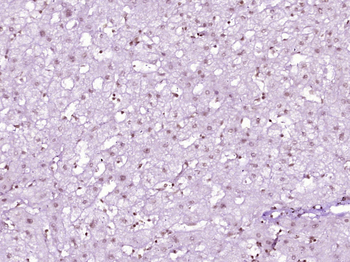 HOXD12 Rabbit Polyclonal Antibody
