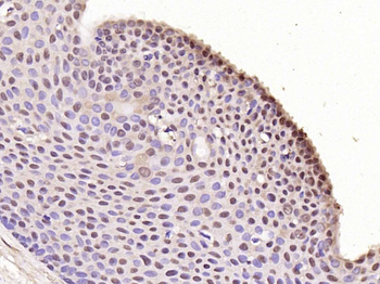 Phospho-C-Myc (Ser373) Rabbit Polyclonal Antibody