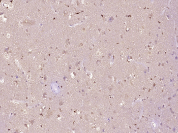 Phospho-HP1 alpha (Ser92) Rabbit Polyclonal Antibody
