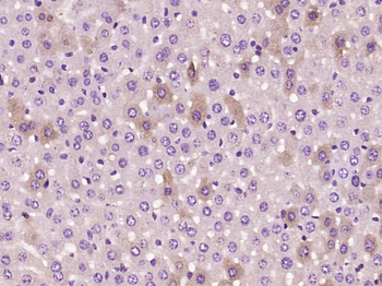 HPS5 Rabbit Polyclonal Antibody