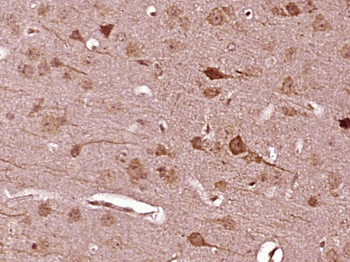 HS3ST5 Rabbit Polyclonal Antibody