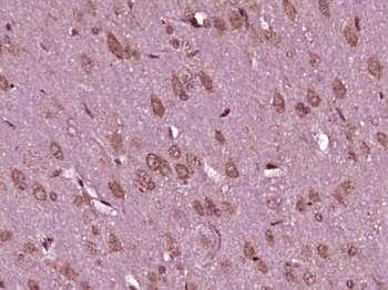 HS3ST5 Rabbit Polyclonal Antibody
