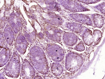 HIST1H2AL Rabbit Polyclonal Antibody