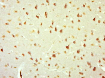 Histone H1.X Rabbit Polyclonal Antibody