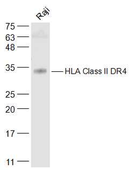 HLA Class II DR4 Rabbit Polyclonal Antibody