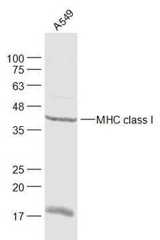 MHC class I Rabbit Polyclonal Antibody