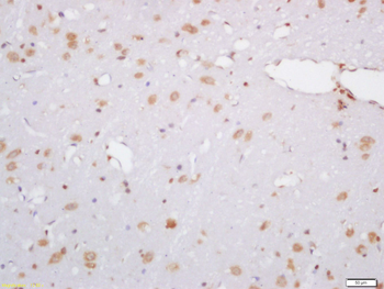 Hydroxyproline Rabbit Polyclonal Antibody