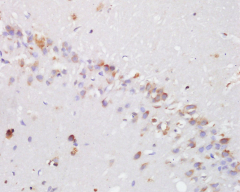 Hydroxyproline Rabbit Polyclonal Antibody