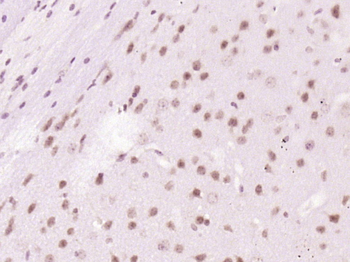 HSPC111 Rabbit Polyclonal Antibody