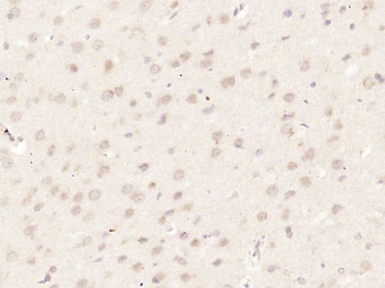 HUS1 Rabbit Polyclonal Antibody