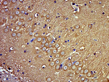 HYLS1 Rabbit Polyclonal Antibody