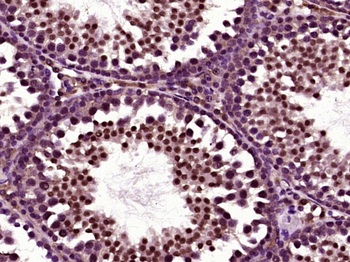 Lin28 Rabbit Polyclonal Antibody