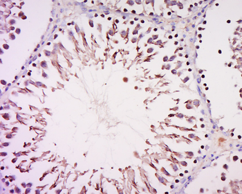 IME1 Rabbit Polyclonal Antibody