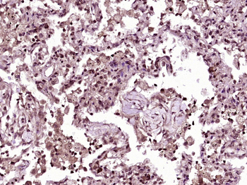 INSM1 Rabbit Polyclonal Antibody