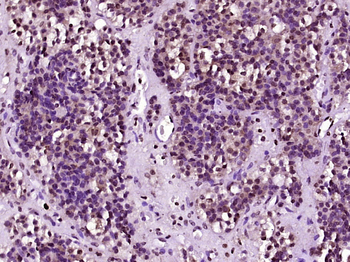 INSM1 Rabbit Polyclonal Antibody