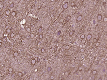 Phospho-Insulin Receptor (Tyr999) Rabbit Polyclonal Antibody
