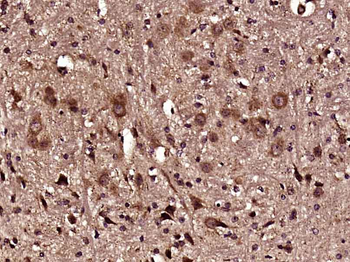 ITPKA Rabbit Polyclonal Antibody