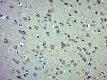 IFNA17 Rabbit Polyclonal Antibody