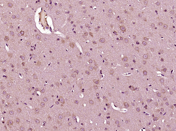 IL23 P19 Rabbit Polyclonal Antibody