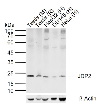 JDP2 Rabbit Polyclonal Antibody