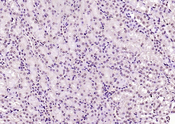KEAP1 Rabbit Polyclonal Antibody