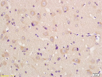 KCC2 Rabbit Polyclonal Antibody